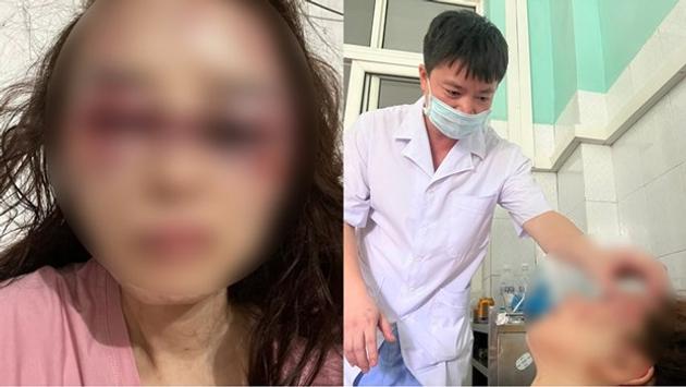 Thanh Hóa: Bắt tạm giam cán bộ quản lý thị trường đánh đập dã man bạn gái 
