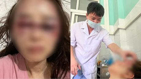 Thanh Hóa: Bắt tạm giam cán bộ quản lý thị trường đánh đập dã man bạn gái 