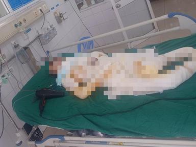 Vụ 3 con gái mang xăng đốt nhà mẹ: Người mẹ đã qua đời