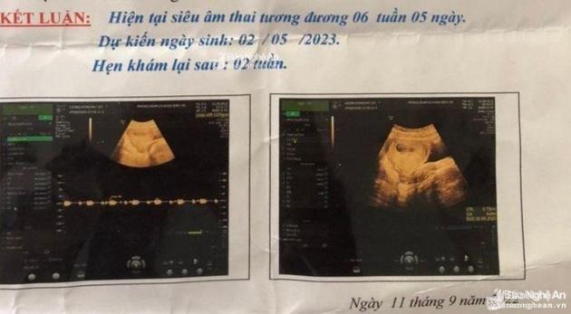 Tạm giữ bảo vệ trường mầm non (70 tuổi) nghi xâm hại nữ sinh lớp 6