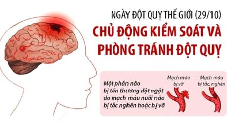 Ngày Đột quỵ thế giới (29/10): Chủ động kiểm soát và phòng tránh đột quỵ
