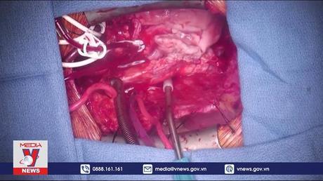 Ca ghép tim lợn cho người đầu tiên trên thế giới