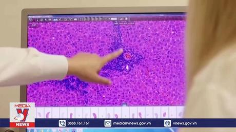 Nam Phi sản xuất vaccine ngừa COVID-19 dựa trên vaccine của Moderna