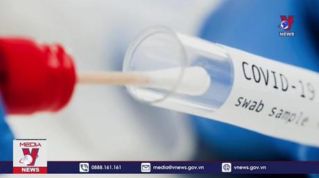 Một doanh nghiệp nhập khẩu hơn 3.400 tỉ đồng kit xét nghiệm COVID-19