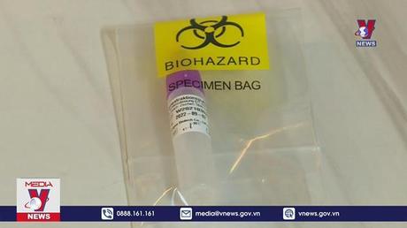 Bộ Y tế yêu cầu bình ổn giá kit test nhanh