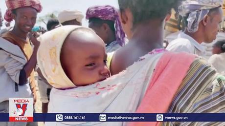 Hàng chục triệu người sẽ rơi vào cảnh nghèo cùng cực trong năm nay