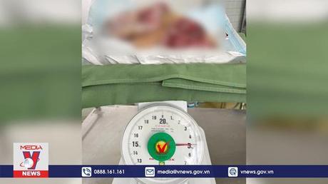 Cắt bỏ khối u nặng 5kg của bệnh nhân ung thư vú