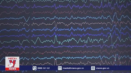 Israel thử nghiệm đo điện não đồ trên ISS