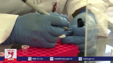 WHO cảnh báo COVID-19 vẫn chưa thể trở thành bệnh đặc hữu