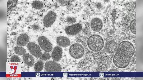 Nhiều nước cảnh giác trước bệnh đậu mùa khỉ