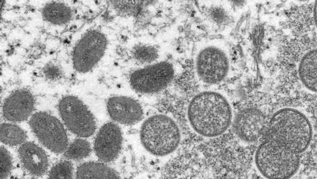 Mỹ mua hàng triệu liều vaccine phòng virus gây bệnh đậu mùa khỉ