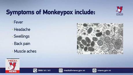 Giới chuyên gia y tế kêu gọi đẩy mạnh ngăn chặn bệnh đậu mùa khỉ