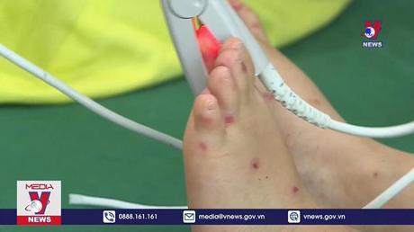 Hà Nội: Số ca mắc sốt xuất huyết giảm, tay chân miệng tăng