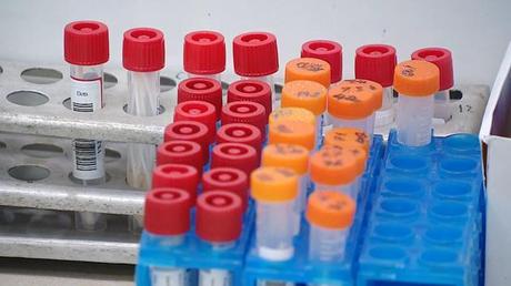 3 ca nhiễm biến chủng phụ Omicron BA.5 có triệu chứng nhẹ.