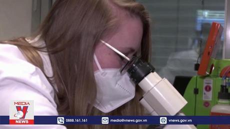 WHO quan ngại về virus đậu mùa khỉ