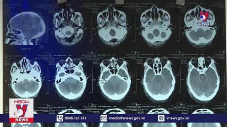 Hai anh em tử vong do ngộ độc rượu