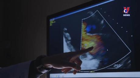 Cấy ghép cơ quan nhân tạo