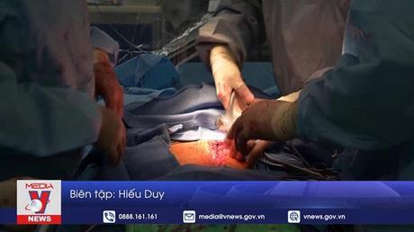 Ghép tim heo thành công cho 2 người chết não