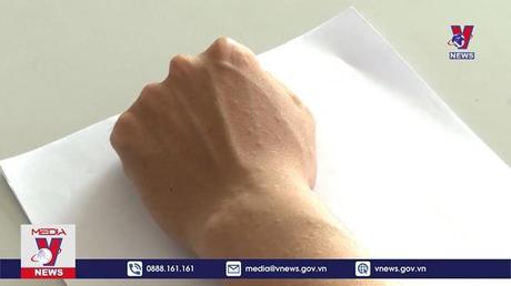 Lạ lùng nghề “ngồi im cho muỗi đốt” 