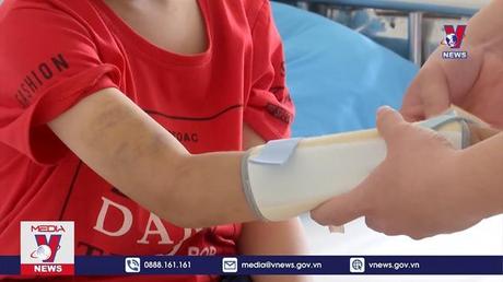 Khởi tố bà nội và cha ruột bạo hành cháu bé 9 tuổi