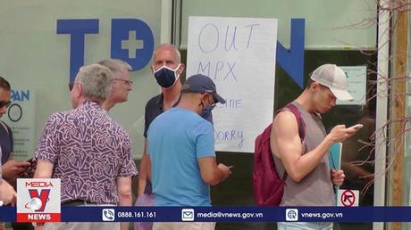 Mỹ tăng cường biện pháp ứng phó bệnh đậu mùa khỉ