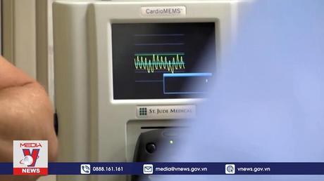 WHO làm rõ nguyên nhân bùng phát đậu mùa khỉ