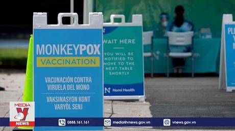 Cuba xác nhận ca bệnh đậu mùa khỉ đầu tiên