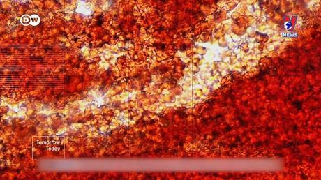 Tạp chí toàn cầu ngày 28/9/2022: Cảm nhận khi tiếp xúc với làn da