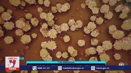 Peru ra mắt ứng dụng theo dõi các ca đậu mùa khỉ