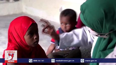 Bệnh sởi hiện là mối đe dọa sắp xảy ra trên toàn cầu