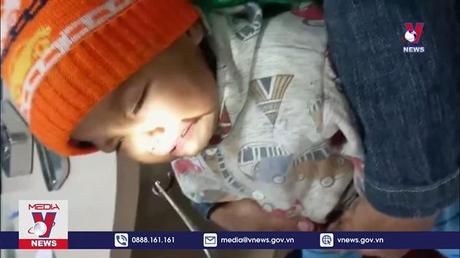 Gắp vắt dài 6cm trong mũi bệnh nhi 10 tháng tuổi
