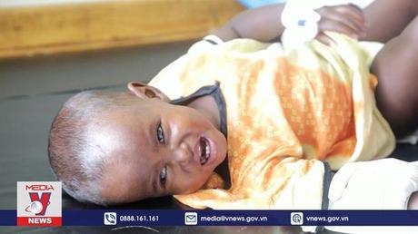 Hơn 20 triệu trẻ em vùng Sừng châu Phi đối mặt nạn đói