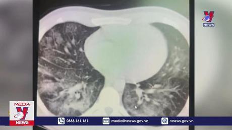 Hiểm họa của thuốc lá điện tử với giới trẻ