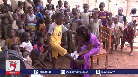 WHO: Hơn 1,65 tỷ người mắc các bệnh nhiệt đới bị lãng quên