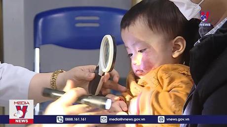 Tăng đột biến bệnh nhi do thời tiết nồm ẩm