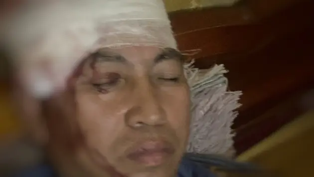 Lái tàu bị ném đá vỡ đầu khi qua Yên Bái
