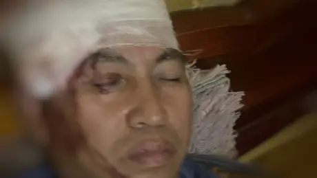 Lái tàu bị ném đá vỡ đầu khi qua Yên Bái
