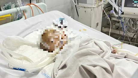 Điều tra vụ bé trai xuất huyết não bất thường tại điểm giữ trẻ tự phát