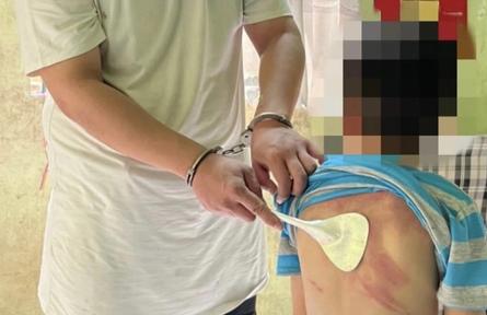 Khởi tố đối tượng hành hạ dã man con ruột