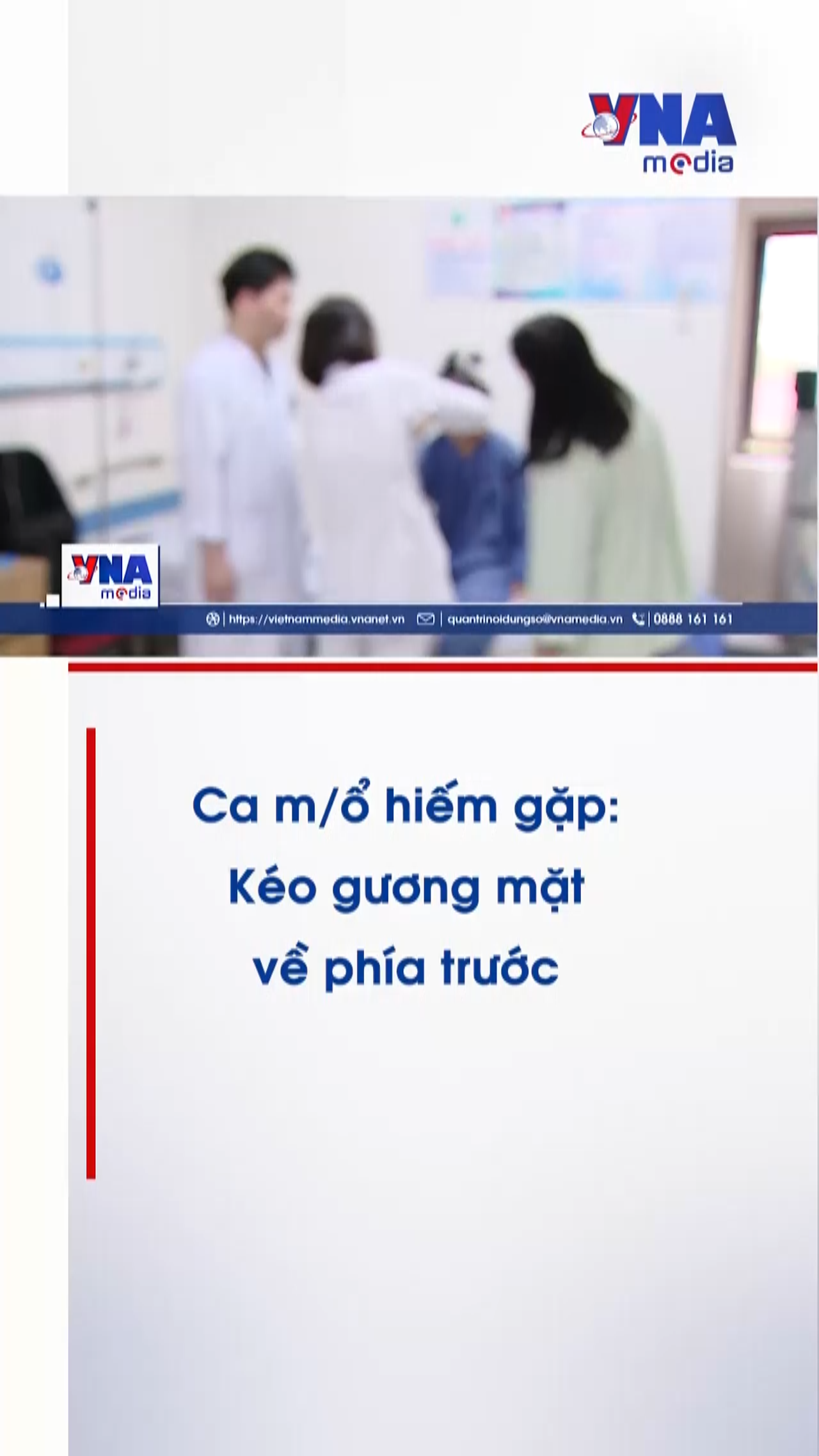 Ca mổ hiếm gặp: Kéo gương mặt về phía trước