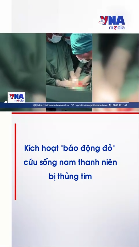
Kích hoạt 