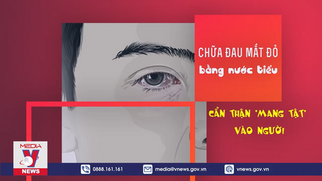 Chữa đau mắt đỏ bằng nước tiểu: Cẩn thận 