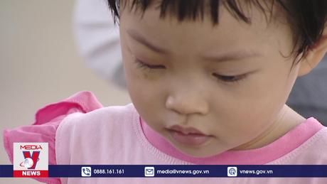 Việt Nam vẫn còn 2 triệu người mù lòa