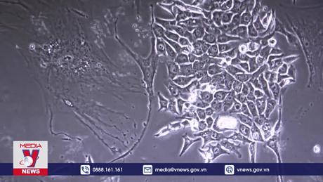 Phương pháp điều trị ung thư ở Nga