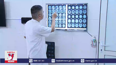 Nguy cơ nhiễm ký sinh trung từ thực phẩm sống