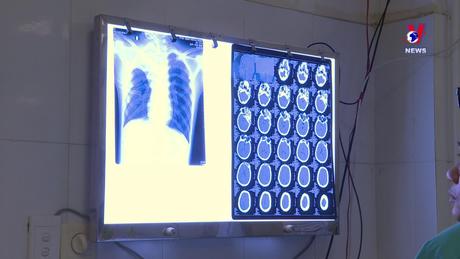 Tai nạn thương tích do pháo tự chế