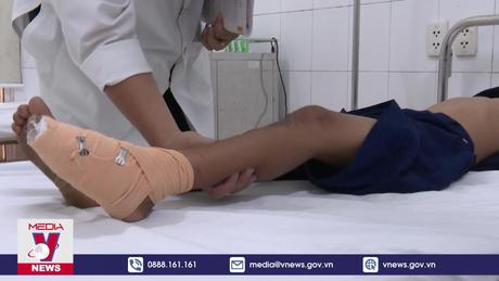 Tai nạn pháo nổ tăng hơn 50% so với Tết Quý Mão 2023