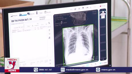 Gánh nặng bệnh lao tại Việt Nam vẫn cao
