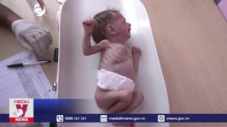 WHO cảnh báo khủng hoảng y tế tại Yemen