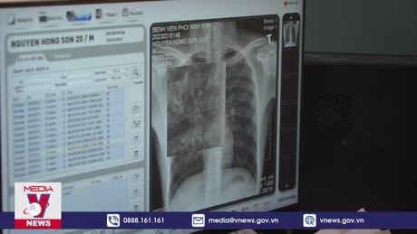 40% ca lao trong cộng đồng chưa được phát hiện